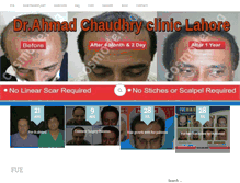 Tablet Screenshot of fuehairtransplantpakistan.com